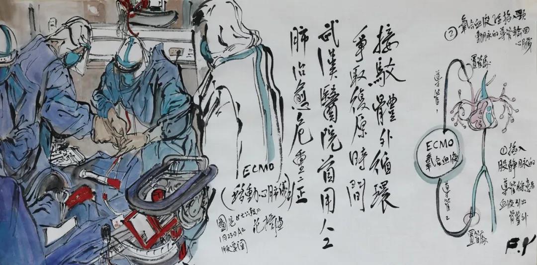 范扬  接驳体外循环争取复原时间 武汉医院首用人工肺治愈危重症  中国画